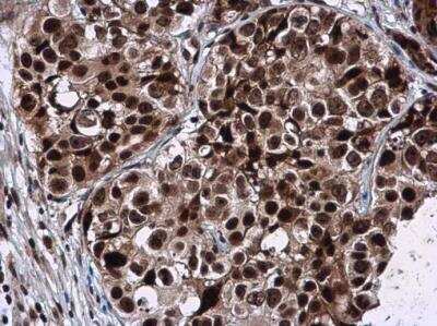 Immunohistochemistry-Paraffin: GPKOW Antibody [NBP2-16714]