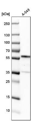 Western Blot: GPKOW Antibody [NBP1-81800]