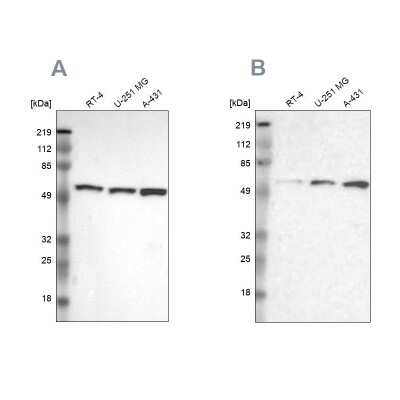Western Blot: GPKOW Antibody [NBP1-81800]