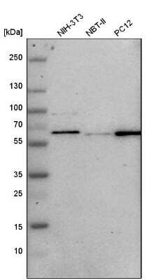 Western Blot: GPKOW Antibody [NBP1-81801]