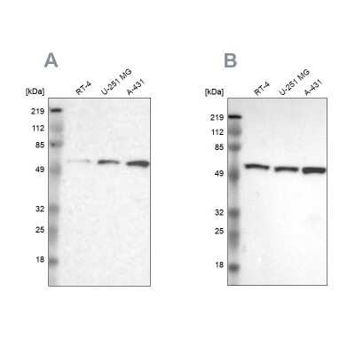 Western Blot: GPKOW Antibody [NBP1-81801]