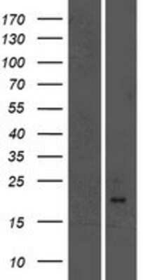 Western Blot: GPI-PLD/GPLD1 Overexpression Lysate [NBP2-05010]