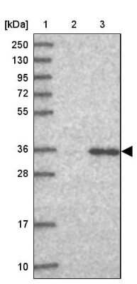 Western Blot: GPN3 Antibody [NBP2-30665]