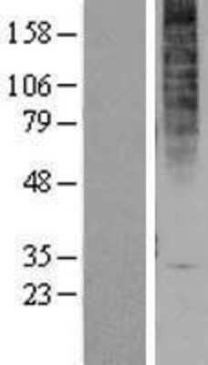 Western Blot: GPR1 Overexpression Lysate [NBP2-04283]