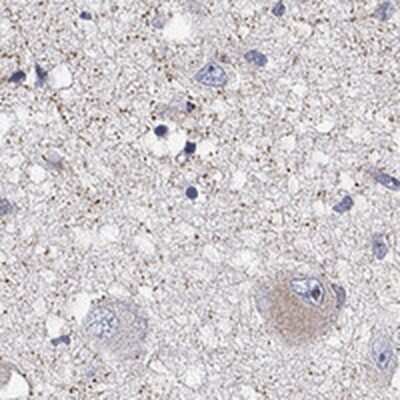 Immunohistochemistry-Paraffin: GPR103 Antibody [NBP3-17376]
