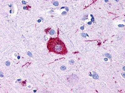 Immunohistochemistry-Paraffin: GPR116 Antibody - BSA Free [NLS1519]