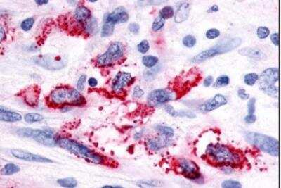 Immunohistochemistry-Paraffin: GPR116 Antibody - BSA Free [NLS1519]