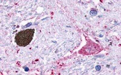 Immunohistochemistry-Paraffin: GPR116 Antibody - BSA Free [NLS1519]