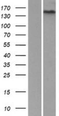 Western Blot: GPR116 Overexpression Lysate [NBP2-10293]