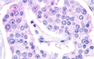 Immunohistochemistry-Paraffin: GPR119 Antibody [NBP3-14344]