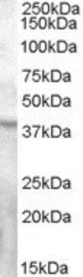 Western Blot: GPR119 Antibody [NB100-94884]