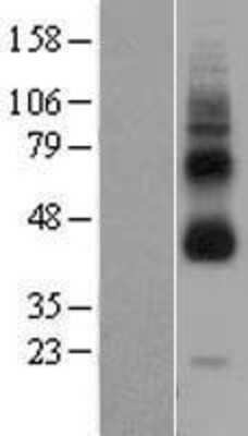 Western Blot: GPR119 Overexpression Lysate [NBL1-11245]