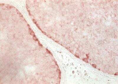 Immunohistochemistry-Paraffin: GPR125 Antibody [NBP1-03561]