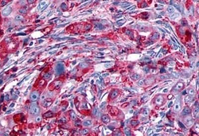 Immunohistochemistry-Paraffin: GPR133 Antibody [NBP3-14348]