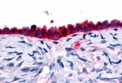Immunohistochemistry-Paraffin: GPR133 Antibody [NBP3-14348]