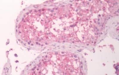 Immunohistochemistry-Paraffin: GPR133 Antibody [NBP3-14348]