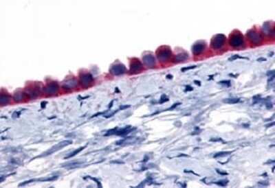 Immunohistochemistry-Paraffin: GPR133 Antibody - BSA Free [NLS2034]