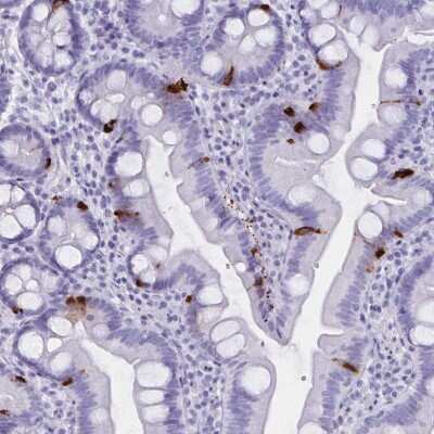 Immunohistochemistry: GPR137 Antibody [NBP2-38976]