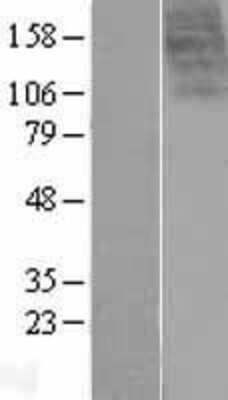 Western Blot: Urotensin-II R/GPR14 Overexpression Lysate [NBP2-06755]