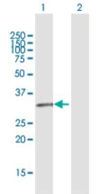 Western Blot: GPR146 Antibody [H00115330-D01P]