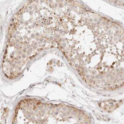 Immunohistochemistry-Paraffin: GPR156 Antibody [NBP1-83402]