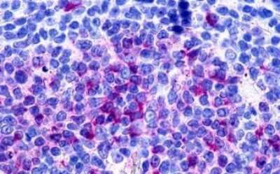 Immunohistochemistry-Paraffin: GPR160 Antibody - BSA Free [NLS542]