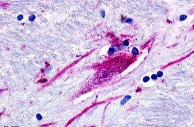 Immunohistochemistry-Paraffin: GPR160 Antibody - BSA Free [NLS542]