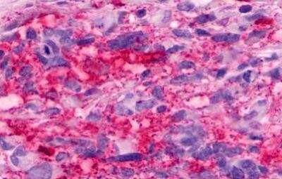 Immunohistochemistry-Paraffin: GPR160 Antibody - BSA Free [NLS542]