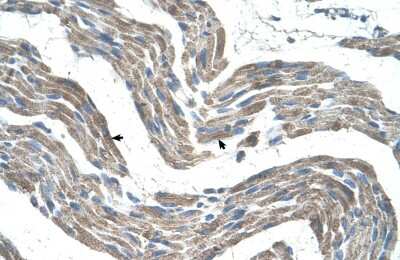 Immunohistochemistry-Paraffin: GPR161 Antibody [NBP1-60114]