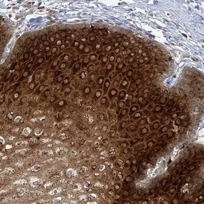 Immunohistochemistry-Paraffin: GPR164 Antibody [NBP2-13701]