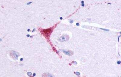 Immunohistochemistry-Paraffin: GPR164 Antibody - BSA Free [NLS1854]