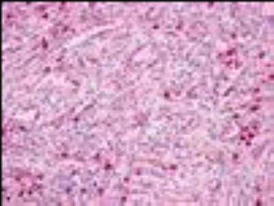 Immunohistochemistry-Paraffin: GPR171 Antibody - BSA Free [NLS1226]