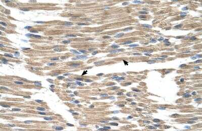 Immunohistochemistry: GPR177/WLS Antibody [NBP2-85009]