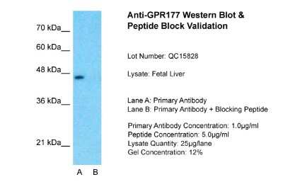 Western Blot: GPR177/WLS Antibody [NBP2-85009]