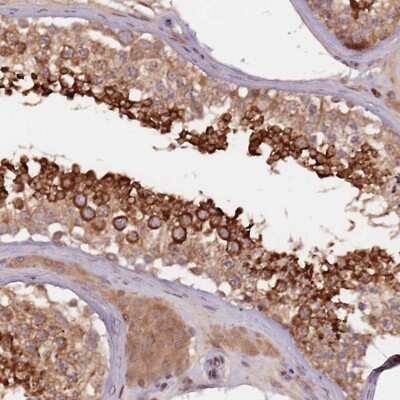 Immunohistochemistry-Paraffin: GPR180 Antibody [NBP2-14068]