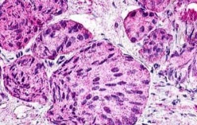 Immunohistochemistry: GPR21 Antibody [NBP3-14353]