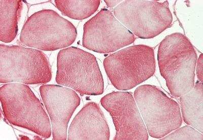 Immunohistochemistry-Paraffin: GPR21 Antibody [NBP2-85013]