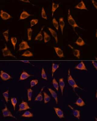 Immunocytochemistry/ Immunofluorescence: GPR22 Antibody - Azide and BSA Free [NBP3-15567]