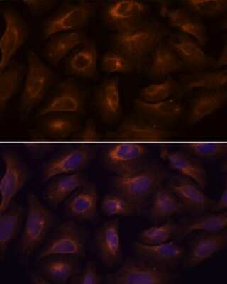 Immunocytochemistry/ Immunofluorescence: GPR22 Antibody - Azide and BSA Free [NBP3-15567]
