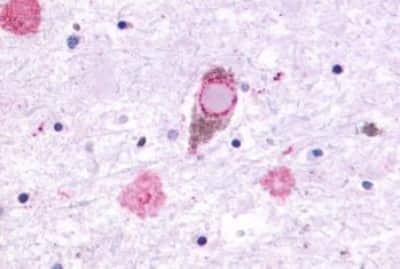 Immunohistochemistry: GPR27 Antibody [NBP3-14356]