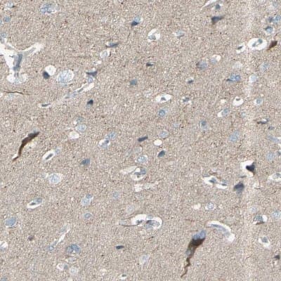 Immunohistochemistry-Paraffin: GPR34 Antibody [NBP1-87583]