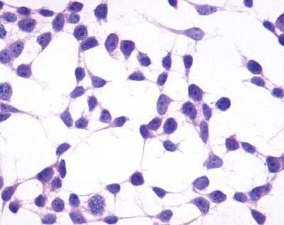 Immunocytochemistry/ Immunofluorescence: GPR4 Antibody - BSA Free [NLS145]