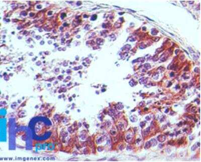 Immunohistochemistry-Paraffin: CRTH-2/GPR44 Antibody (54N3F8) - BSA Free [NBP2-19014]
