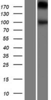 Western Blot: Lgr4/GPR48 Overexpression Lysate [NBP2-06791]