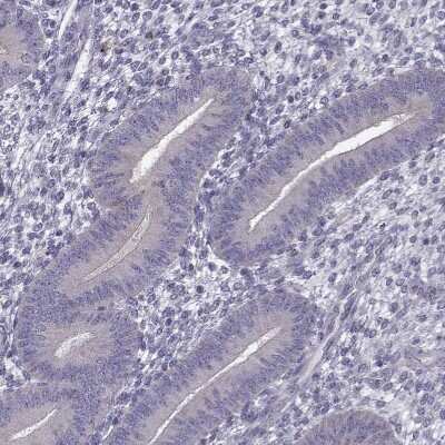 Immunohistochemistry-Paraffin: GPR64 Antibody [NBP1-84906]