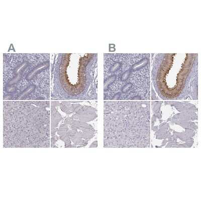 Immunohistochemistry-Paraffin: GPR64 Antibody [NBP1-84906]