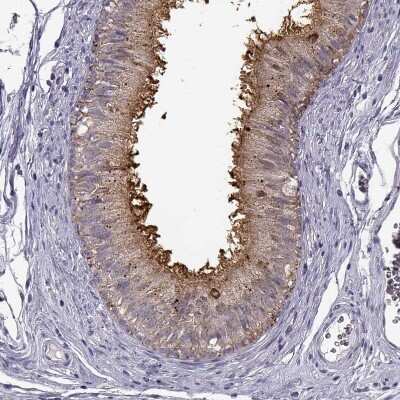 Immunohistochemistry-Paraffin: GPR64 Antibody [NBP1-84906]