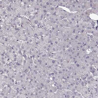 Immunohistochemistry-Paraffin: GPR64 Antibody [NBP1-84906]