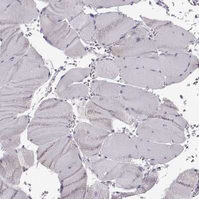 Immunohistochemistry-Paraffin: GPR64 Antibody [NBP1-84906]