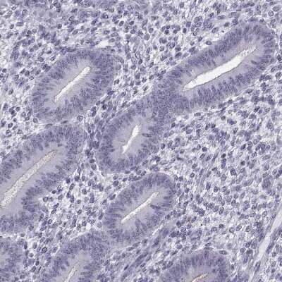 Immunohistochemistry-Paraffin: GPR64 Antibody [NBP2-55504]